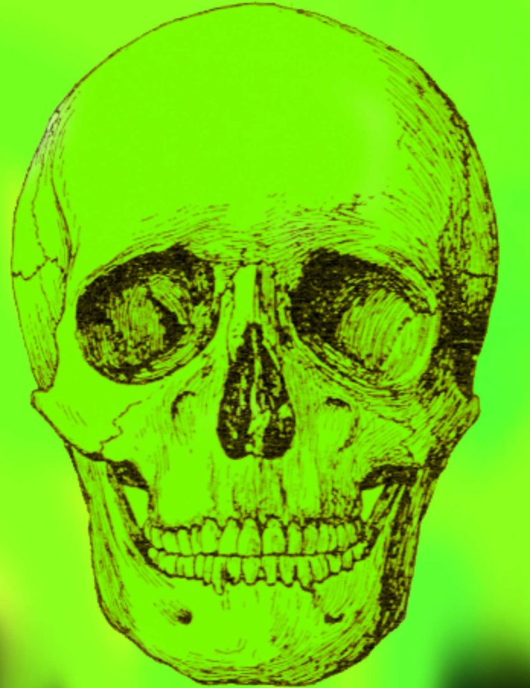Radioactive skull